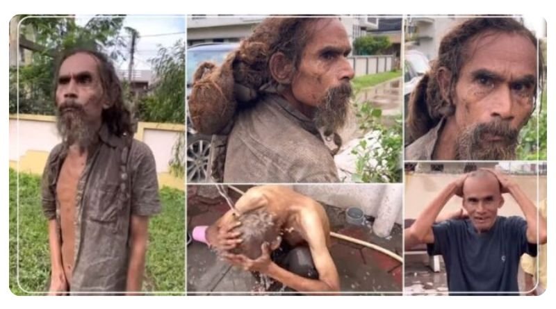 Although this brother is the owner of 1 crore he has been living a miserable life for 25 years