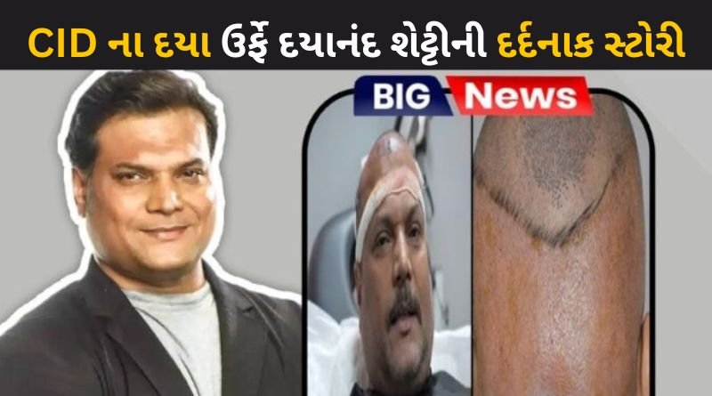 The painful story of CID's Daya aka Dayanand Shetty