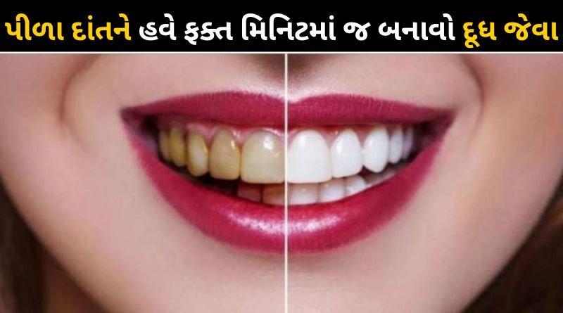 Home remedies for yellow teeth