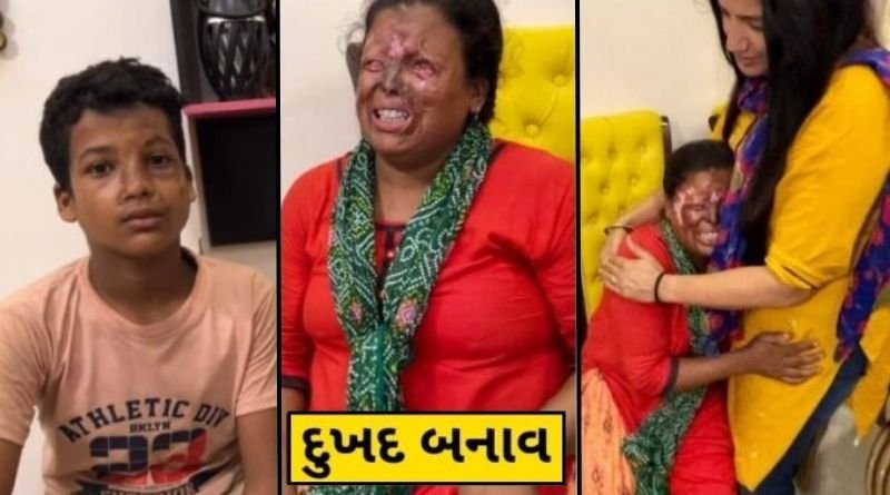 Someone attacked this woman with acid in the middle of the night