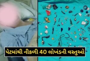 More than 40 iron objects found in the stomach of a 40 year old youth