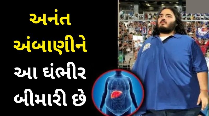 Anant Ambani is suffering from this serious disease! Nita Ambani told the truth