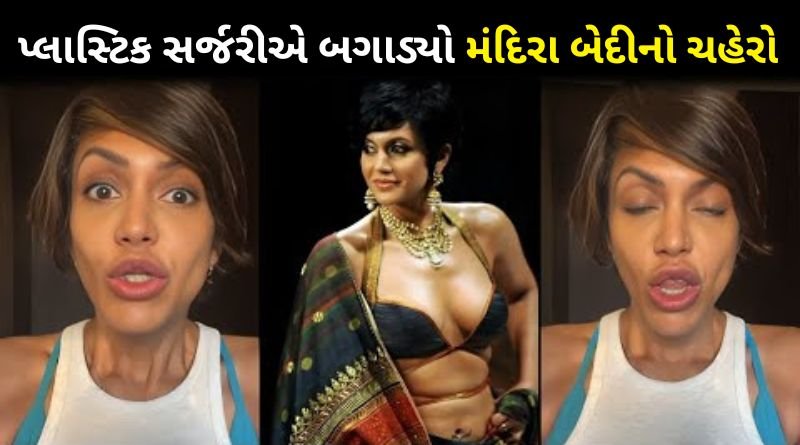 51 year old actress Mandira Bedi got plastic surgery done to look young