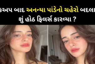 Ananya Panday's lips stole the limelight