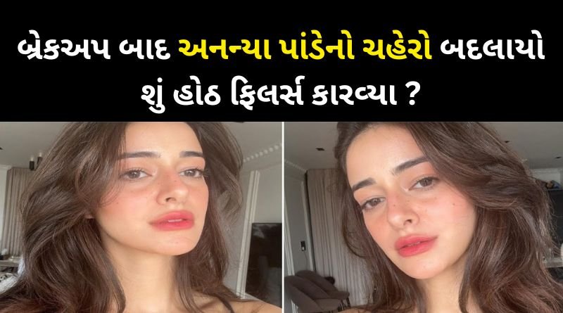 Ananya Panday's lips stole the limelight