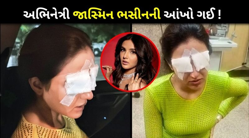 Actress Jasmin Bhasin Lost Eye Vision